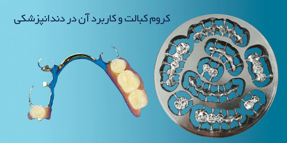 کاربرد کروم کبالت در دندانپزشکی