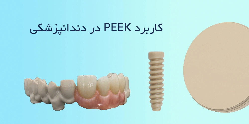 کاربرد PEEK در دندانپزشکی
