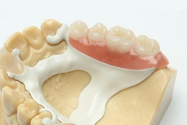 استفاده‌های مختلف از PEEK در دندانپزشکی