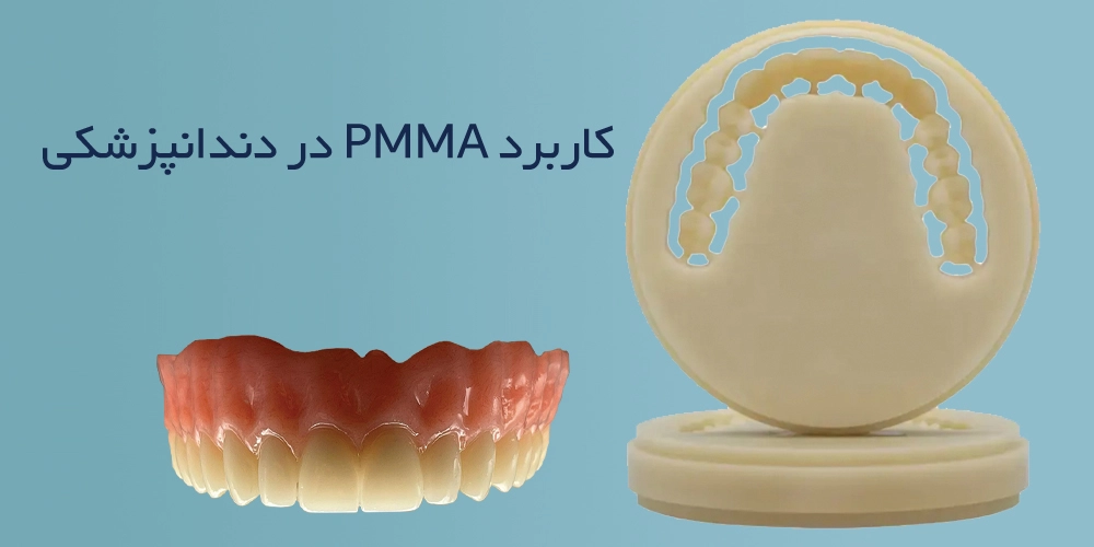استفاده از PMMA در دندانپزشکی